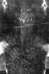 Shroud of Turin | Back of Jesus' head - negative